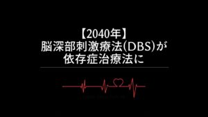 【2040年】脳深部刺激療法(DBS)が依存症治療法に